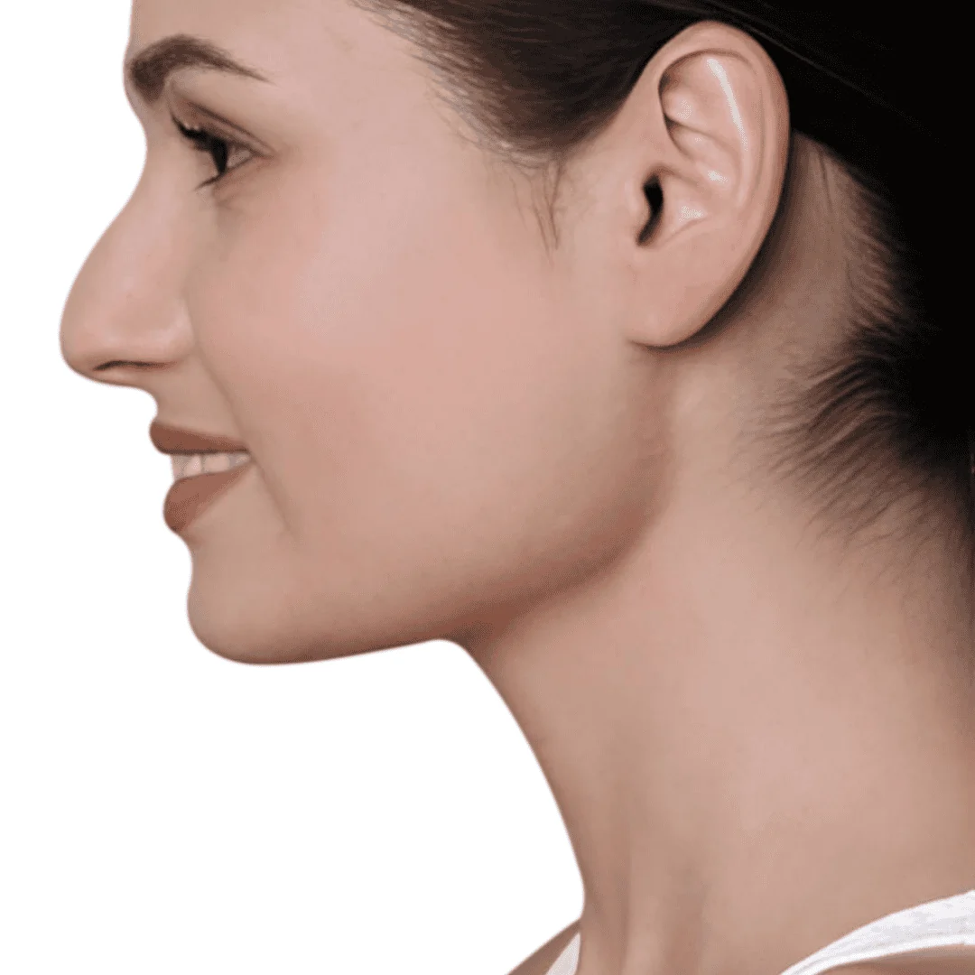 skin-care-treatments-in-kochi-after-double-chin