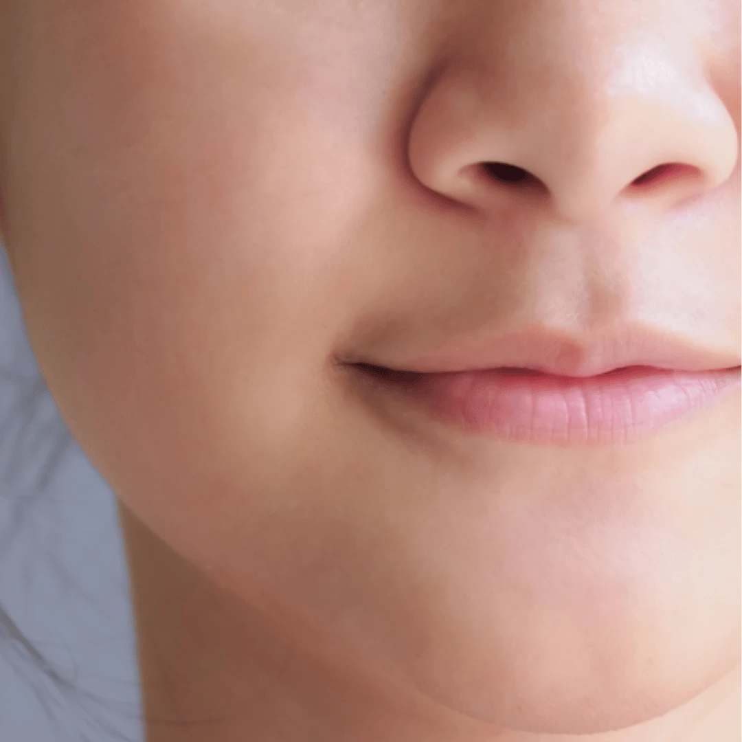 skin-treatment-center-in-kochi-lip-pigmentation