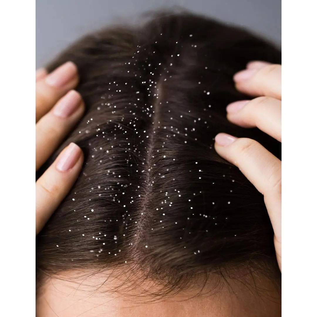 top-hair-care-treatments-in-kochi